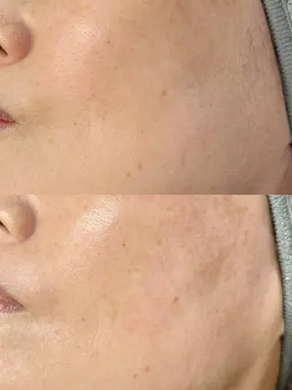 alors所属・alors shimoのマツエク・マツパデザイン