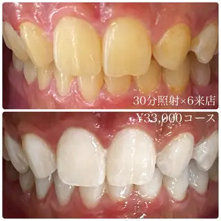 メンズ ホワイトニングルーム　川崎店所属・ホワイトニング ルーム　川崎店のその他イメージ