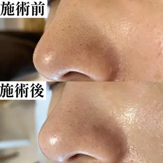 毛穴専門サロン　フルール所属・フルールFululu 自由が丘のエステ・リラクイメージ