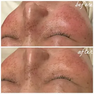 メンズ メナード岐阜市茜部 杉浦のエステ・リラクイメージ