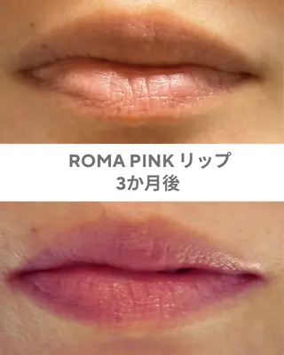 GrandAzure 大人の肌改善のエステ・リラクイメージ