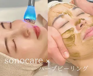 美肌脱毛＆小顔・フェ イシャル【SONA】のエステ・リラクイメージ