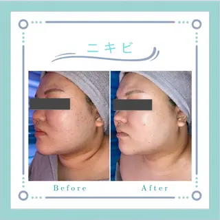 フェイシャルエステLe・Ciel所属・Le・Ciel フェイシャル&ボディのエステ・リラクイメージ