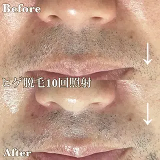 MINOA所属・MINOA 井上🌷のエステ・リラクイメージ