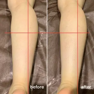 脱毛＆エステサロン JIGGLY☆松田のエステ・リラクイメージ