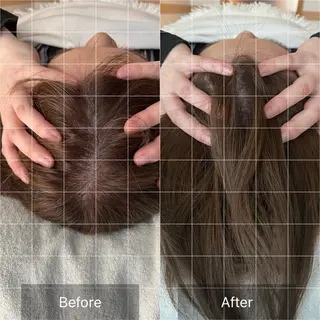 肌育ピーリング 🫧megumiのエステ・リラクイメージ