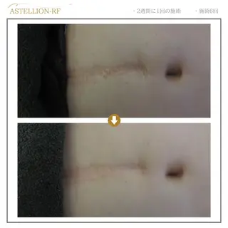 Sylphya (シルフィア)のエステ・リラクイメージ