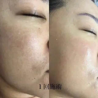 アロマビューティー カオリのネイルデザイン