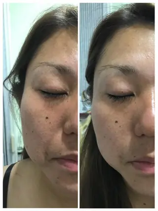 武蔵浦和　小顔矯正 リーフ　　武蔵浦和店のエステ・リラクイメージ