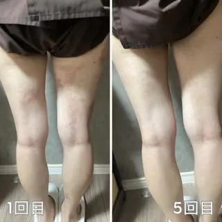 リラクゼーション ～絃～のエステ・リラクイメージ