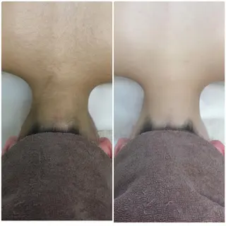 エステティックレイ ビス秋田店 菅野のエステ・リラクイメージ