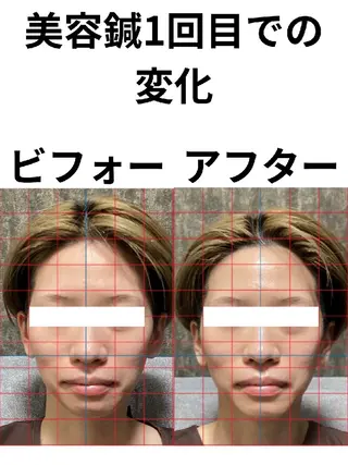 鍼灸整体院アレンジ所属・鍼灸整体院 アレンジのその他イメージ