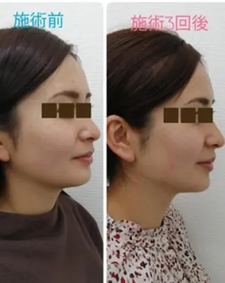 CORAL湘南平塚店所属・【小顔・美容専門】 🐠リカのエステ・リラクイメージ