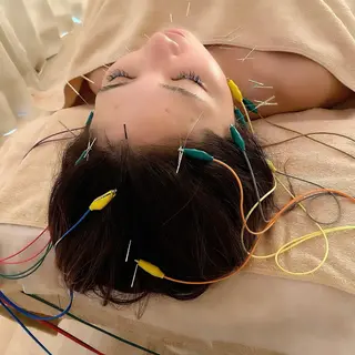 美容鍼灸サロンRemeリミー所属・美容鍼WINBACK サロンRemeのエステ・リラクイメージ