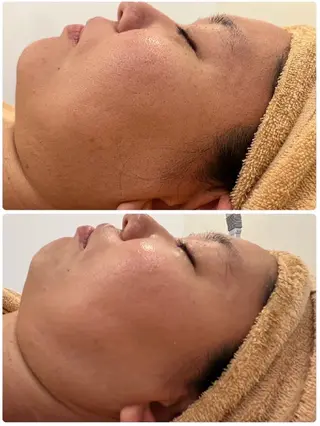 LOUISE.／脱毛所属・LOUISE. ／脱毛のエステ・リラクイメージ