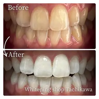 セルフ ホワイト ニングショップ立川のその他イメージ