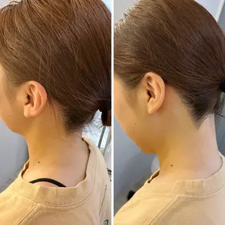 うなじ脱毛/美肌脱毛 LABELのエステ・リラクイメージ