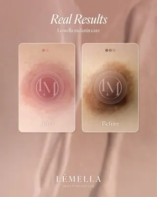 H Maiのエステ・リラクイメージ