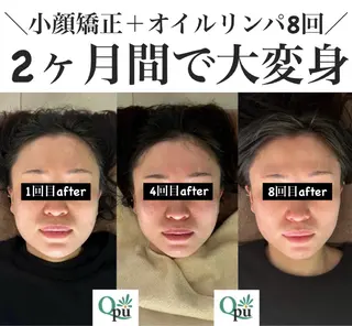 Qpu(キュープ)下北沢店所属・鮎川 さゆりのエステ・リラクイメージ