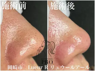 大久保 里奈のエステ・リラクイメージ