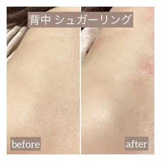 脱毛＆エステサロン JIGGLY☆松田のエステ・リラクイメージ