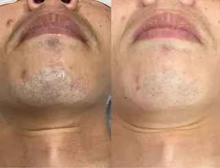 Tug エステサロン　高知駅前店所属・高知駅店Tug NONOKAのエステ・リラクイメージ