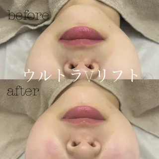 フェイシャルサロン CHIARA 荒田のエステ・リラクイメージ