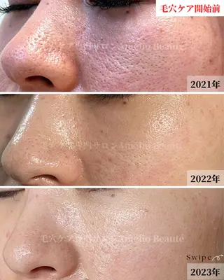 メンズ 毛穴ケア専門サロン Amélio Beauté所属・毛穴ケア専門サロン アメリオボーテのその他イメージ