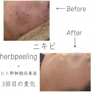 miki 東根の肌質改善サロンのエステ・リラクイメージ