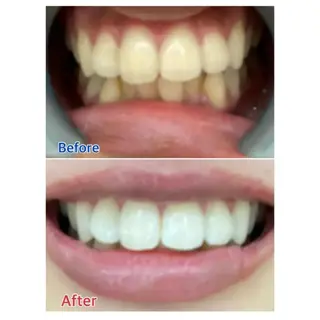 M渋谷店所属・M渋谷 ホワイトニングのエステ・リラクイメージ