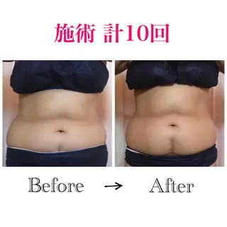 &. BYのエステ・リラクイメージ