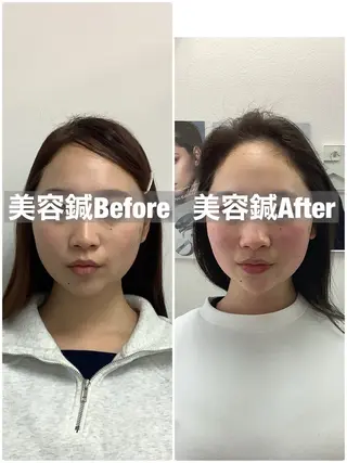 メディカルサロンドオフ所属・ハリサロンドオフ 美容鍼灸×小顔整体のエステ・リラクイメージ