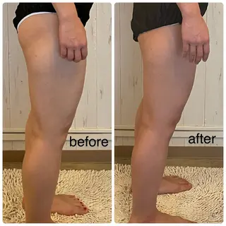 小顔・たるみケア✨ フェイシャル&ボディのエステ・リラクイメージ