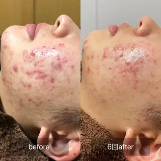 未病ケアサロン　EMINY所属・未病ケアサロン EMINY☺︎勝俣のエステ・リラクイメージ