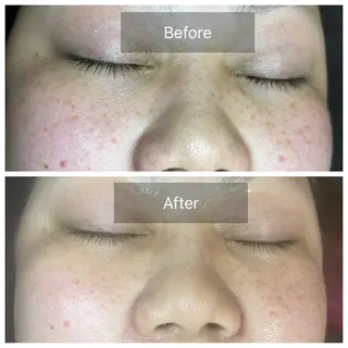 肌質改善サロン facialmoonのエステ・リラクイメージ