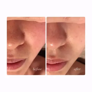 private salon hanaのエステ・リラクイメージ