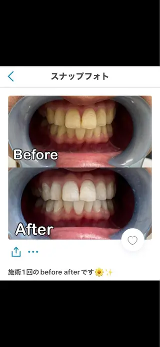 WHITENING ハウスのマツエク・マツパデザイン