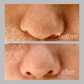 salon DAHLIA所属・salon DAHLIAのエステ・リラクイメージ