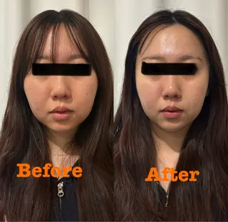 鍼灸サロン mahorobaトモのエステ・リラクイメージ