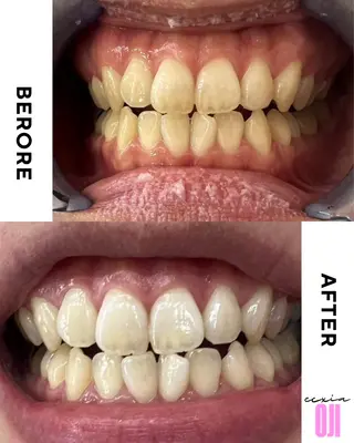 セルフホワイトニングサロン  エクシアホワイト 王寺店所属・エクシア王寺 NISHIKAWAのその他イメージ