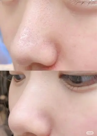 マツエク・マツパ aliaハイフ&水光ジェットサロン所属・aliaハーブ水光店 エステティシャン募集のエステ・リラクイメージ