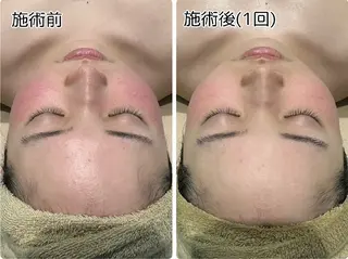 LOUISE.所属・LOUISE. ／ネイルのネイルデザイン