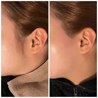 Ｂ&H所属・頭痛•肩こり専門/ 眉サロンB&H心斎橋のエステ・リラクイメージ