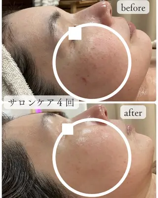 老廃物流し屋 沼倉のエステ・リラクイメージ