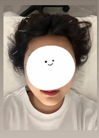 札幌鍼灸FUJIKAWA所属・札幌鍼灸 FUJIKAWAのエステ・リラクイメージ