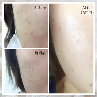 シミ・肌育サロン Jullyのエステ・リラクイメージ