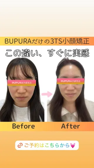小顔矯正と肌改善✨ BUPURA宇都宮店のエステ・リラクイメージ