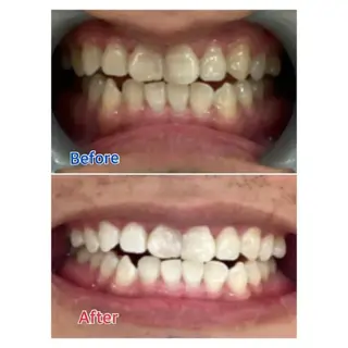 M渋谷店所属・M渋谷 ホワイトニングのエステ・リラクイメージ