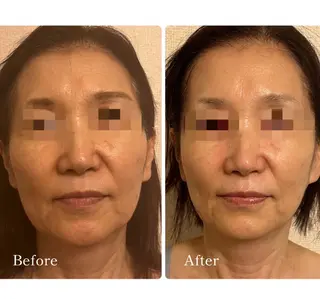 Total Beauty salon Bloom所属・肌育WISHpro 専門サロンBloomのエステ・リラクイメージ