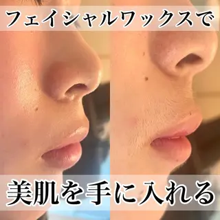 amu nail. RINAのネイルデザイン